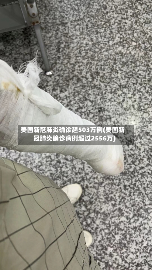 美国新冠肺炎确诊超503万例(美国新冠肺炎确诊病例超过2556万)-第3张图片